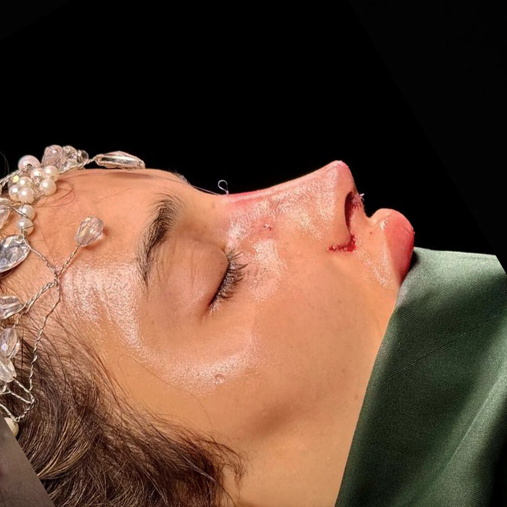 Clinic Results Gallery